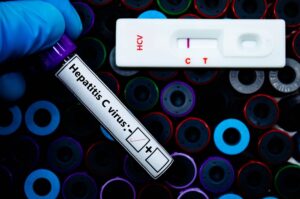 ADH_Hepatitis-C
